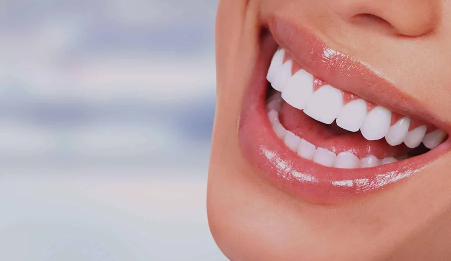 Lentes de contato dental em Santos